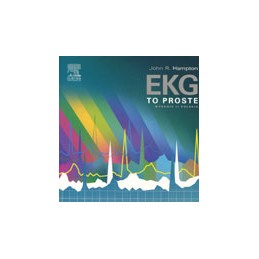 EKG - TO PROSTE