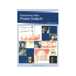 Ilustrowany atlas protez...