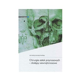 Chirurgia zatok...