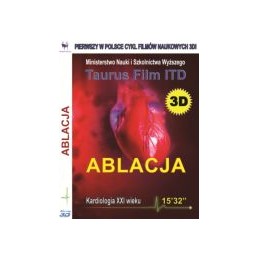 Ablacja w trzepotaniu...