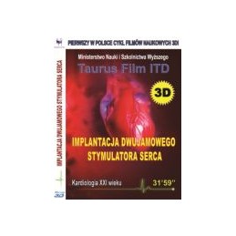 Implantacja dwujamowego...