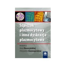 Szpiczak plazmocytowy i...