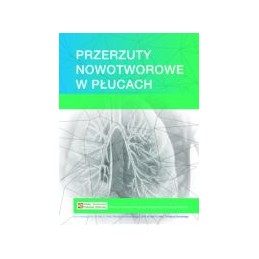 Przerzuty nowotworowe w płucach