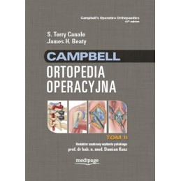 Campbell Ortopedia operacyjna - tom 2