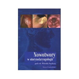 Nowotwory w...