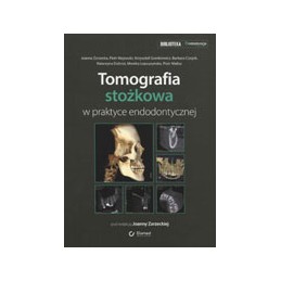 Tomografia stożkowa w...