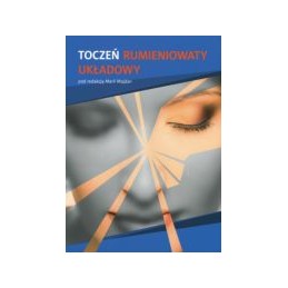 Toczeń rumieniowaty układowy