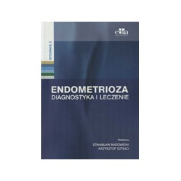 Endometrioza - diagnostyka i leczenie