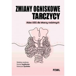 Zmiany ogniskowe tarczycy.