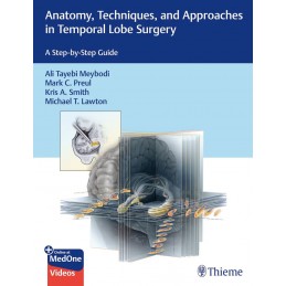 Anatomy, Techniques, and...