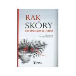 Rak skóry