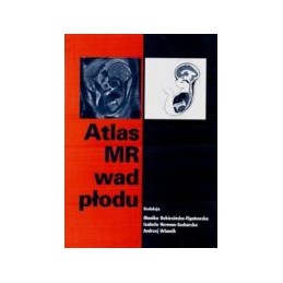 Atlas MR wad płodu