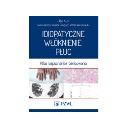 Idiopatyczne włóknienie płuc