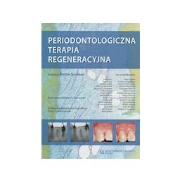 Periodontologiczna terapia...