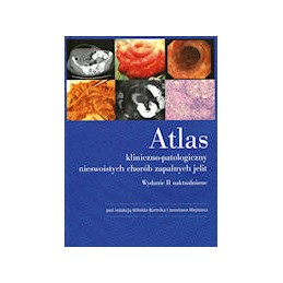 Atlas...