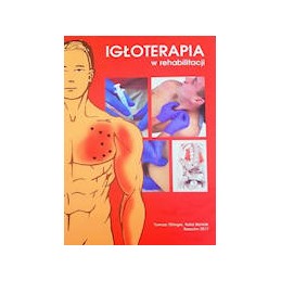 Igłoterapia w rehabilitacji
