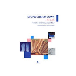 Stopa cukrzycowa - atlas