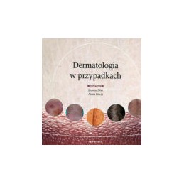Dermatologia w przypadkach