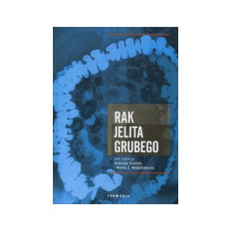 Rak jelita grubego