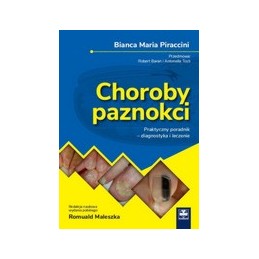 Choroby paznokci