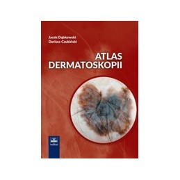 Atlas dermatoskopii