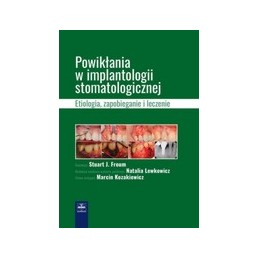 Powikłania w implantologii...