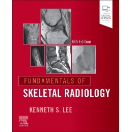 Fundamentals of Skeletal Radiology