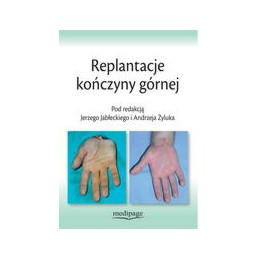 Replantacje kończyny górnej