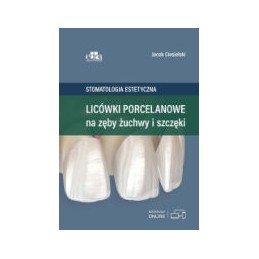 Licówki porcelanowe na zęby żuchwy i szczęki