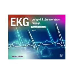 EKG - pułapki, które...