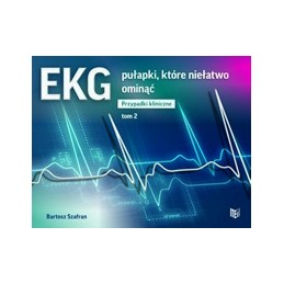 EKG - pułapki, które...