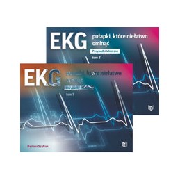 EKG - pułapki, które...
