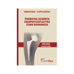 Pierwotna całkowita endoprotezoplastyka stawu biodrowego