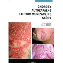 Choroby autozapalne i...