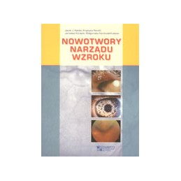 Nowotwory narządu wzroku