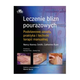 Leczenie blizn pourazowych....