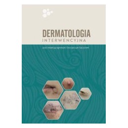 Dermatologia interwencyjna