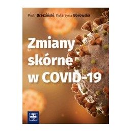 Zmiany skórne w COVID-19