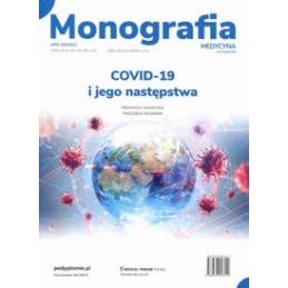 COVID-19 i jego następstwa