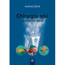 Chirurgia ręki - ciekawe...