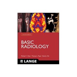 Basic Radiology, Second Edition