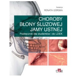 Choroby błony śluzowej jamy ustnej. Podręcznik dla studentów i do LDEK