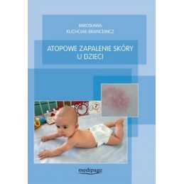 Atopowe zapalenie skóry u...