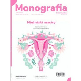 Mięśniaki macicy