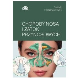 Choroby nosa i zatok...