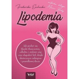 Lipodemia