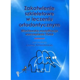 Zakotwienie szkieletowe w...