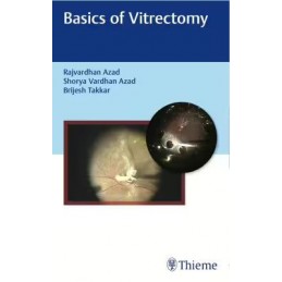 Basics of Vitrectomy