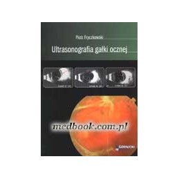 Ultrasonografia gałki ocznej