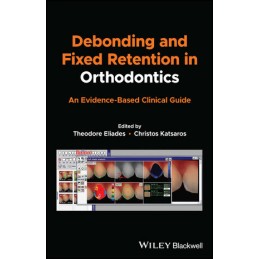 Debonding and Fixed...